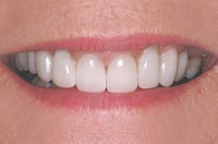 fanged_after_textmedium