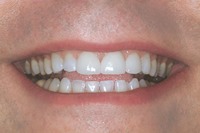 spaced_after_textmedium